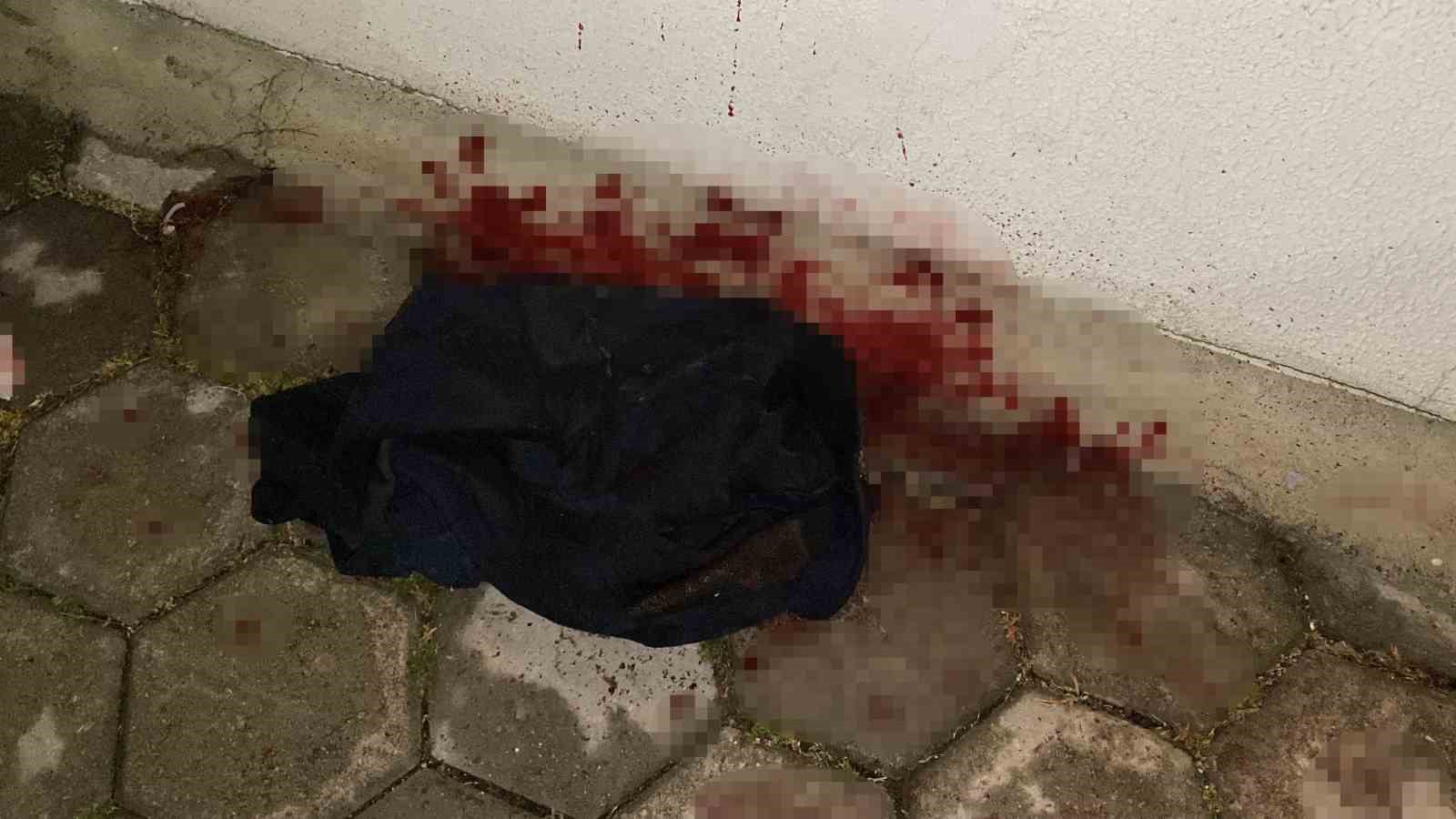 Yan bakma kavgasında 17 yaşındaki çocuk bıçaklandı 