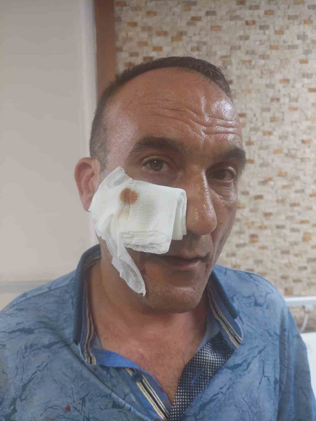 Yol verme kavgası taksi durağına taştı: 2 yaralı 