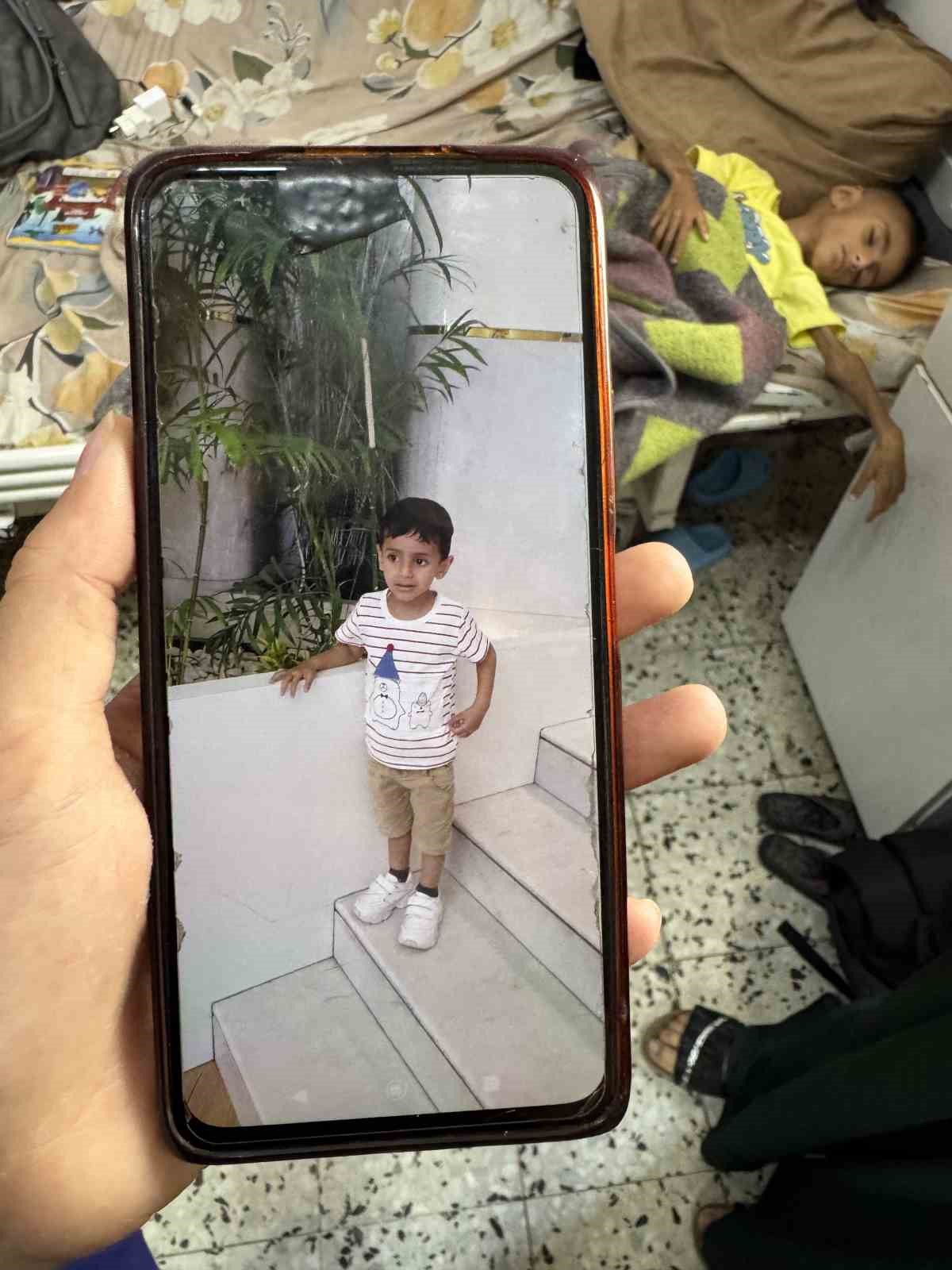 UNICEF Gazze’de yetersiz beslenen 5 yaşındaki bir çocuğun İsrail saldırıları öncesi ve sonrasına ait fotoğraflarını paylaştı