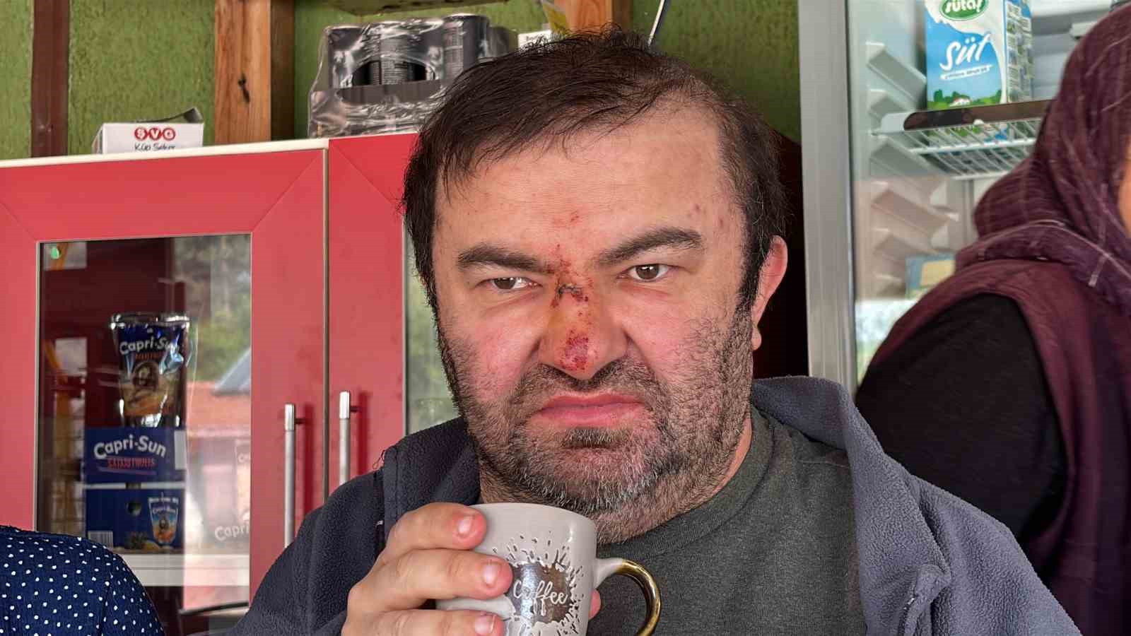 Yüzde 90 engelli vatandaş acımasızca darp edildi 