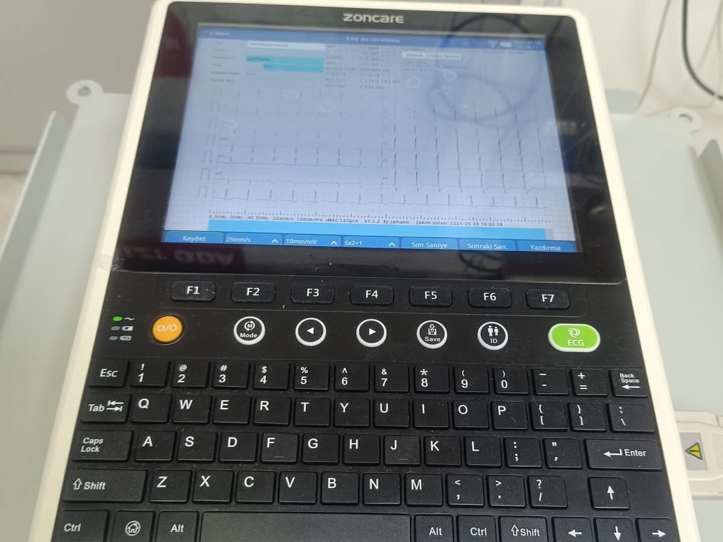 Gerze Devlet Hastanesi’ne 12 kanallı dijital EKG cihazı 