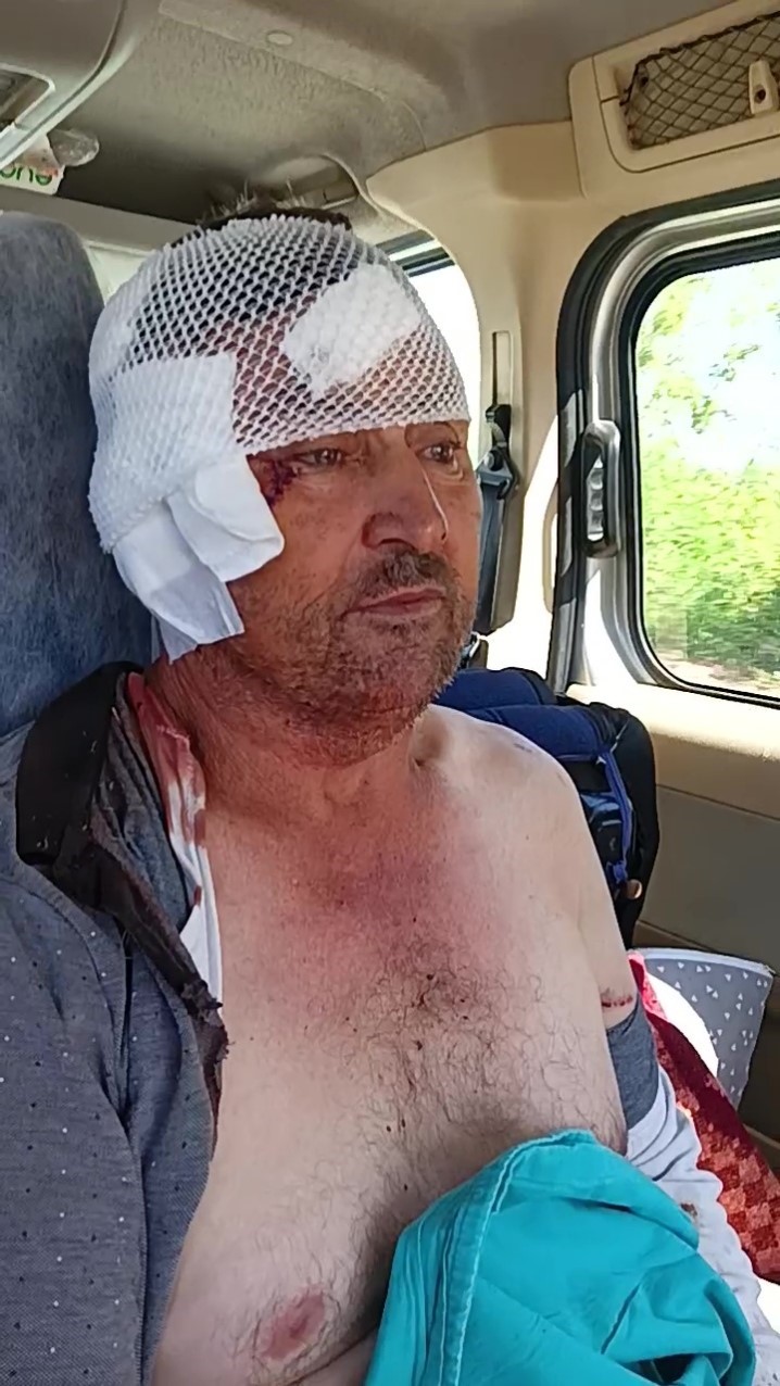 Aslanın saldırısına uğrayan çiftçi o anları anlattı: 