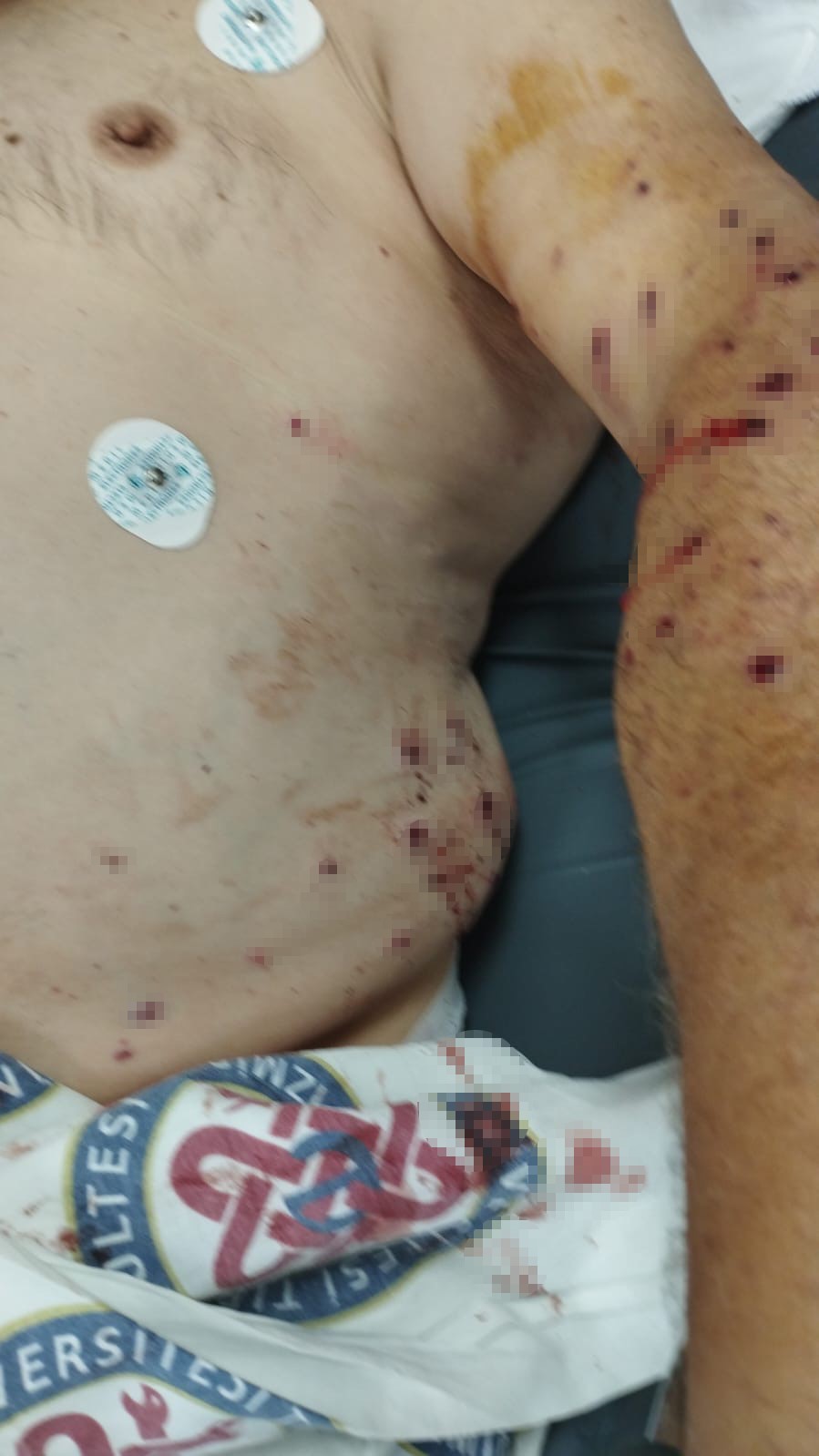 İzmir’de tır sahibi 180 liralık kantar ücreti için çalışanı vurdu 