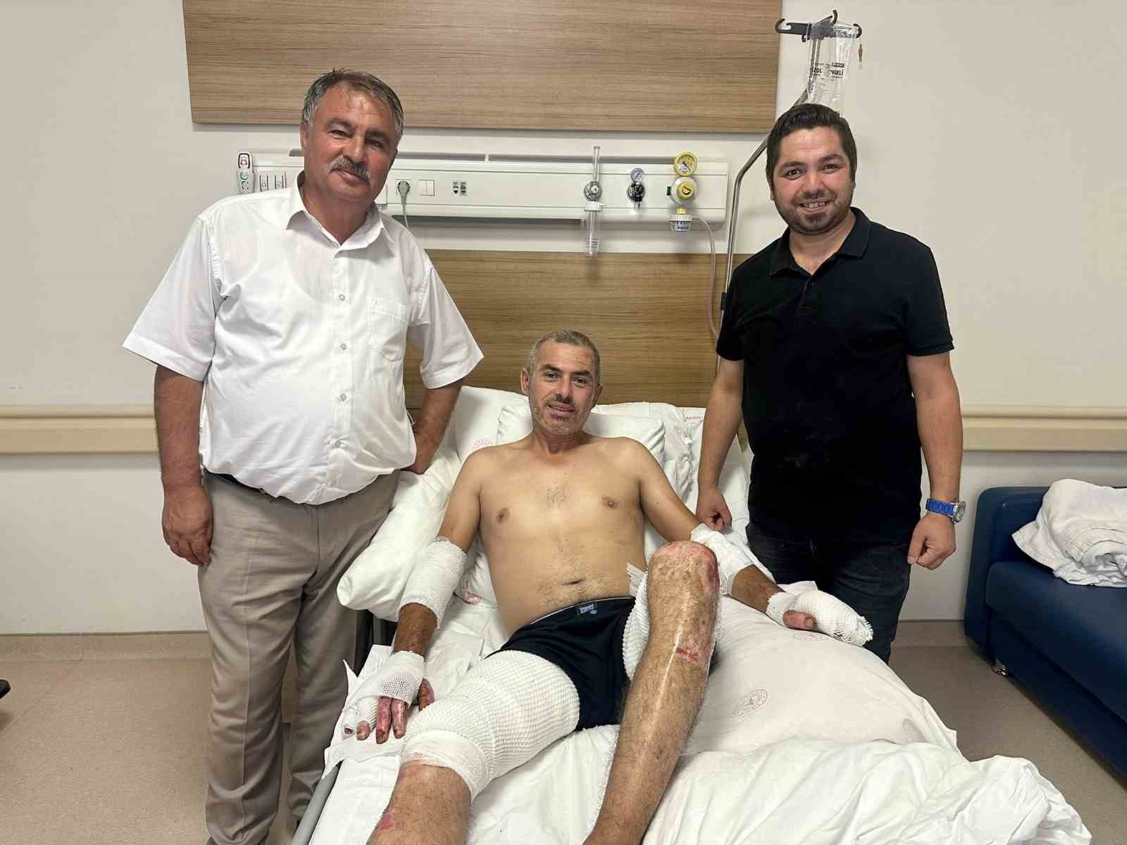 Başkan Pütün Eskişehir yangınında yaralanan orman işçisini yalnız bırakmıyor 