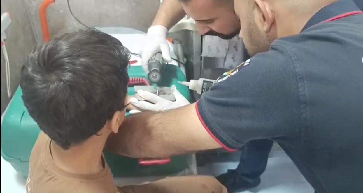 Çocuğun parmağına sıkıştırdığı cıvata pulu kesilerek çıkartıldı 
