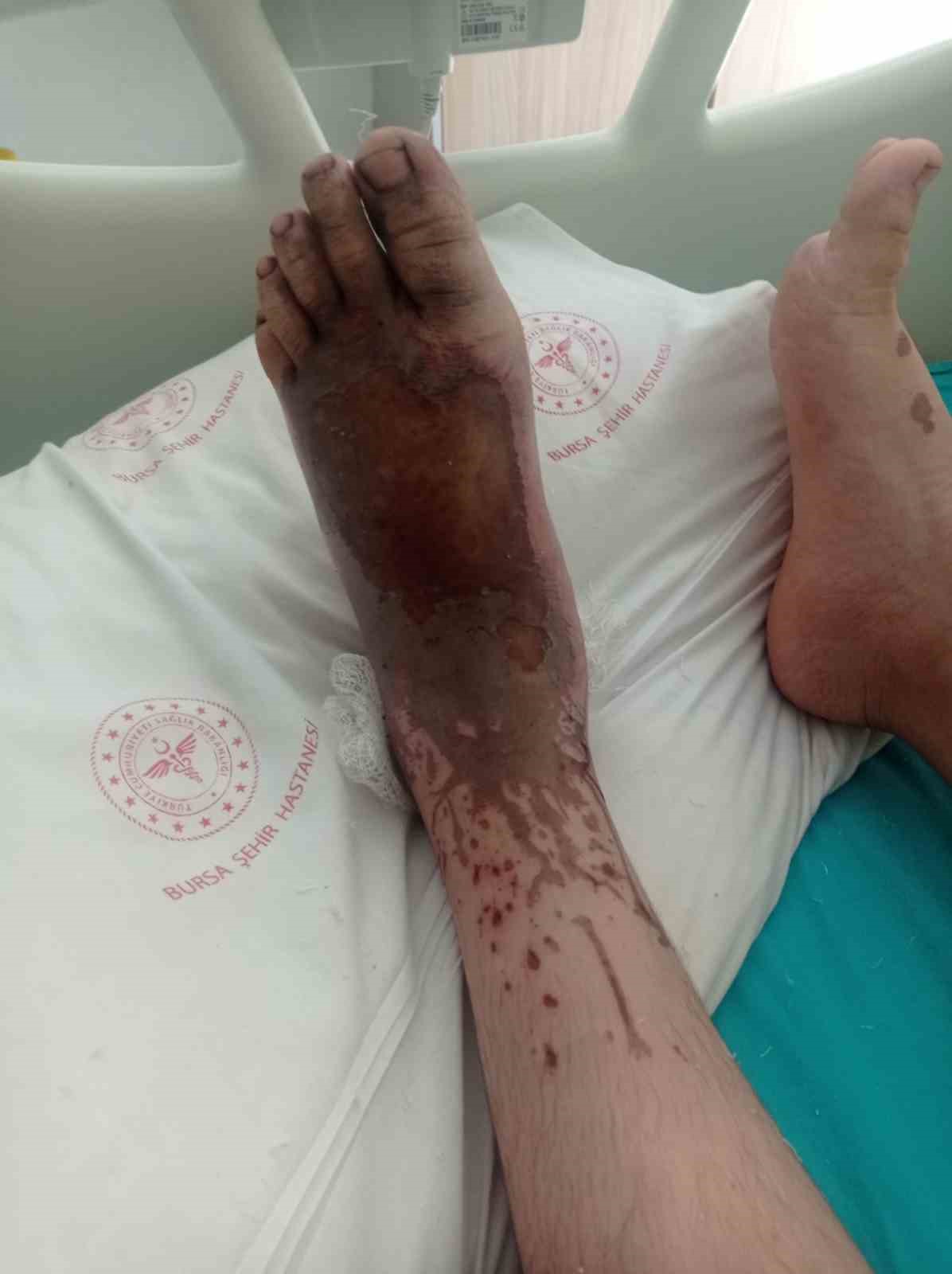 Ailesine maddi destek olmak isterken, ayaklarından oluyordu 