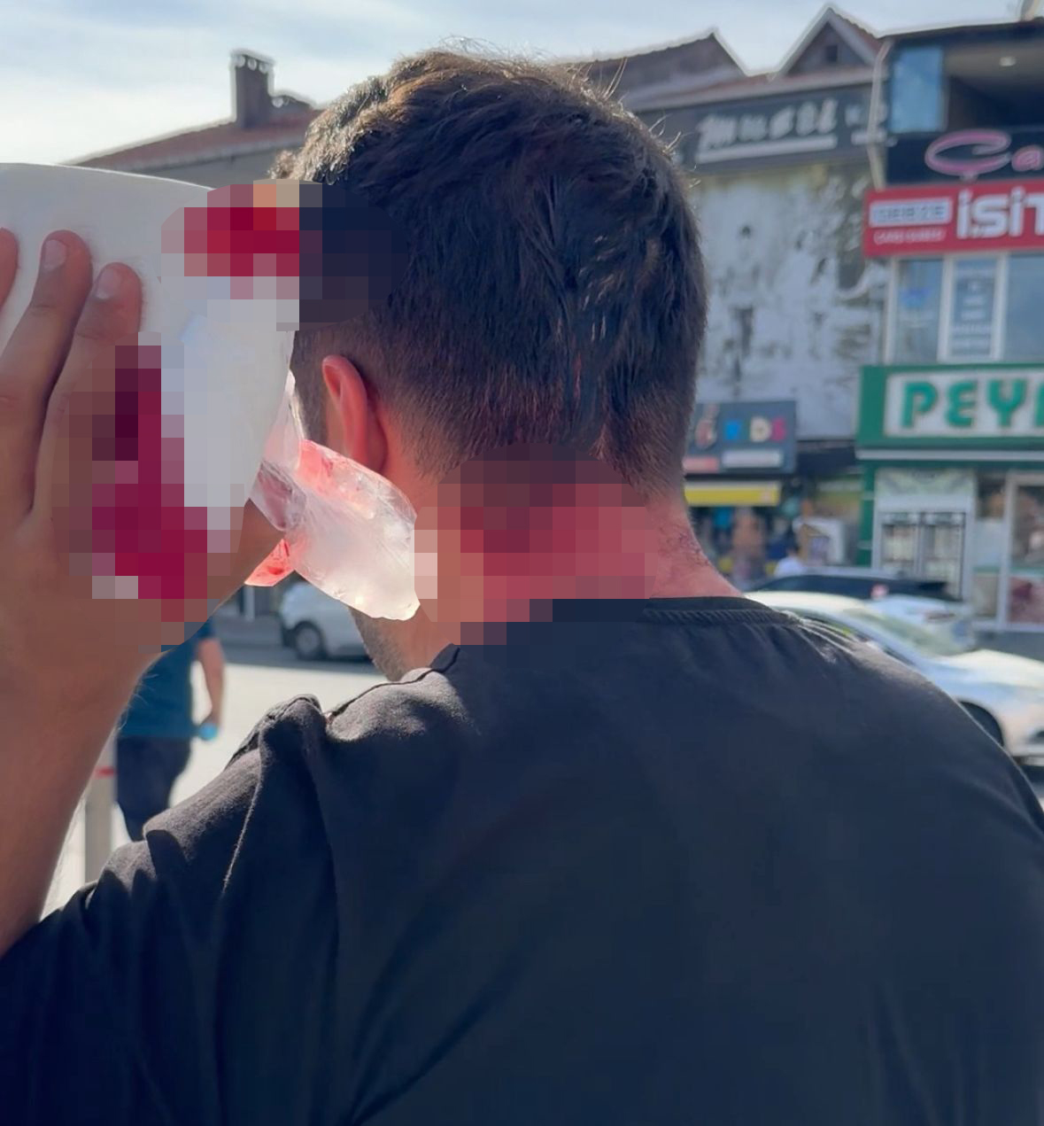 Vekilin cenazesinde darbedilip hastanelik oldu 