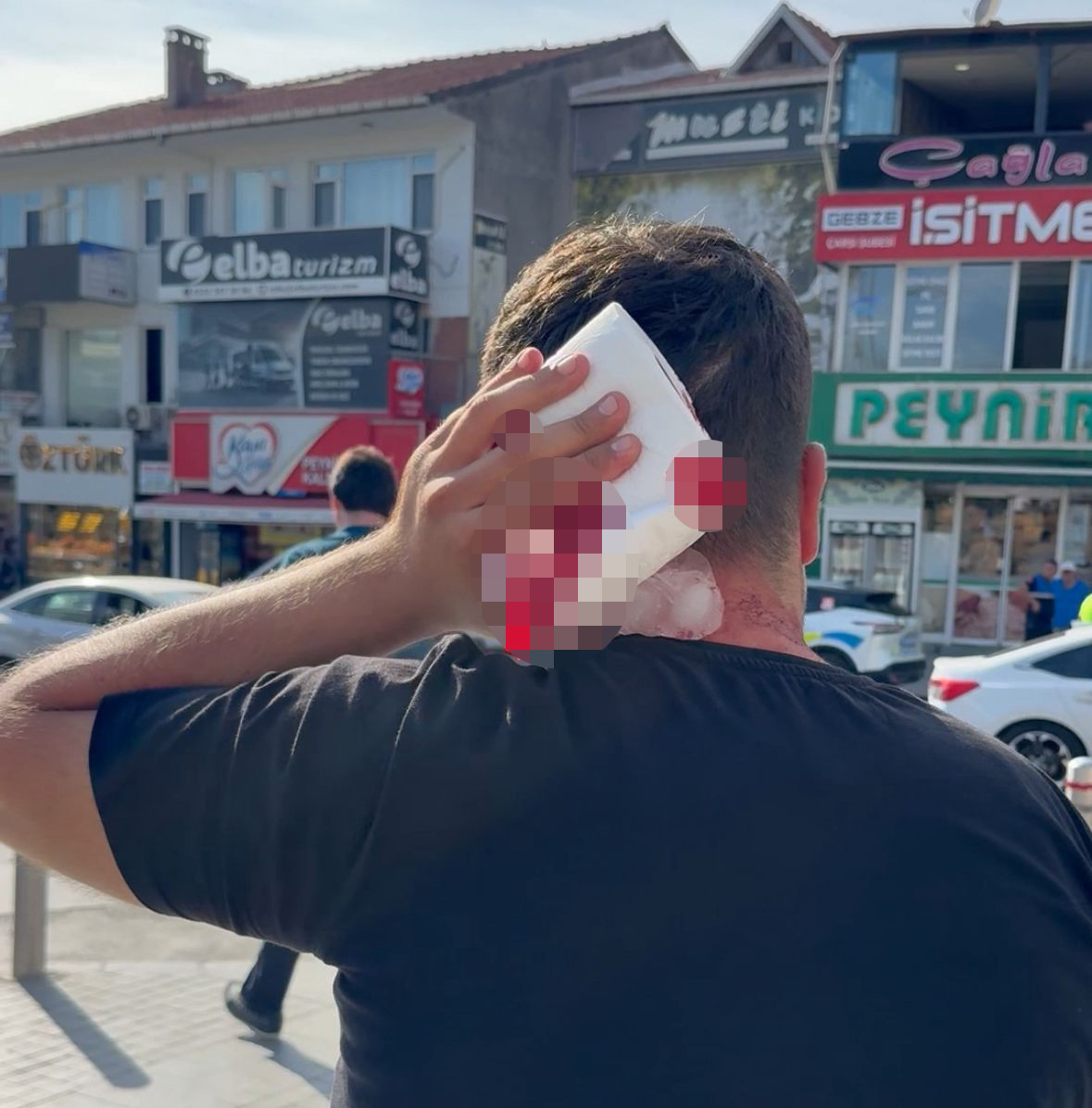 Vekilin cenazesinde darbedilip hastanelik oldu 