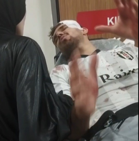 Mahalle maçı kavgaya dönüştü: 2 yaralı 